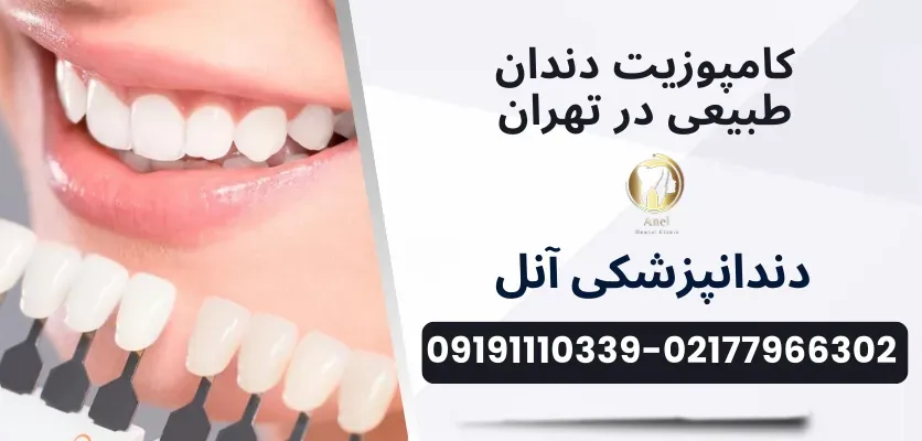 ترمیم دندان در شرق تهران