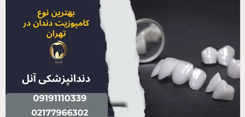 ترمیم دندان در شرق تهران